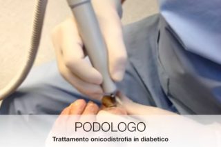 Caso práctico Uña encarnada
